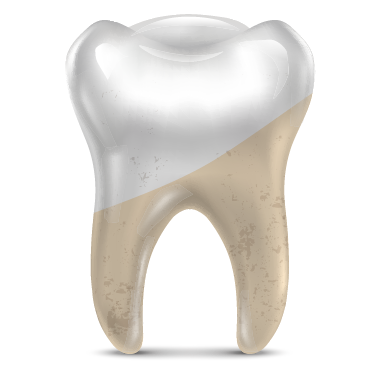 Dolgunn Ürün Görseli 1